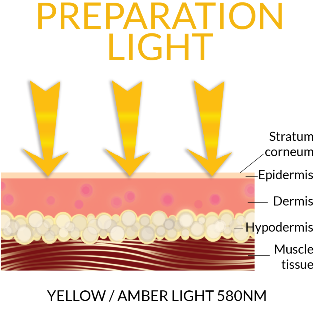 Diagram of skin cell layers in response to Preparation light